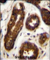 Maspin Antibody (Center)