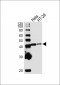 Maspin Antibody (Center)