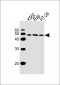 IL13RA1 Antibody (C-term)
