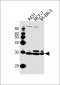 CTSD(heavy chain) Antibody (Center)