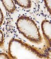 CHML Antibody (C-term)