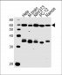 Pyruvate Kinase (PKM2) Antibody (C-term)