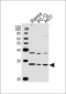 GRB2 Antibody (Y209)