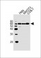 HDAC2 Antibody (Center)