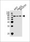 EIF2AK2 Antibody