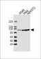 FER Antibody