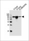 FLT1 Antibody