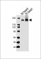 MYBPC3 Antibody (N-term)