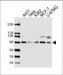 PLOD1 Antibody (N-term)