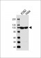 EIF4G2 Antibody (N-term)