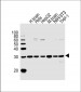 RAB35 Antibody (C-term)