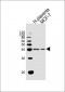 BCAT2 Antibody (N-term)