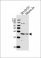 STX1B Antibody (Center)