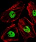 (Mouse) Smarcc1 Antibody (C-term)