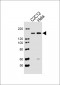 (Mouse) Smarcc1 Antibody (C-term)