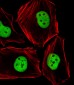 (Mouse) Smarcc1 Antibody (C-term)