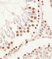 (Mouse) Smarcc1 Antibody (C-term)