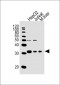 CTDSP1 Antibody (Center)