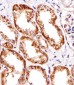 INSRR Antibody (Center)