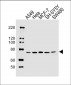 INSRR Antibody (Center)