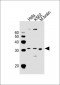 CHMP3 Antibody (N-term)