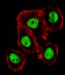 Mouse Ctr9 Antibody (C-term)