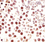 Mouse Ctr9 Antibody (C-term)