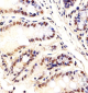 Mouse Ctr9 Antibody (C-term)