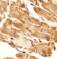 EHD2 Antibody (C-term)