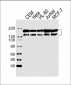 ABL1 Antibody (C-term)