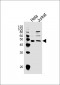 AVPR2 Antibody (C-term)