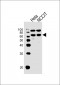 GNL3 Antibody (N-term)