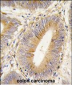 AKR1B1 Antibody (Center)