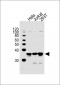AKR1B1 Antibody (Center)