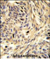 HSPD1 Antibody (C-term)