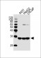 TPI1 Antibody (C-term)