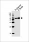 SERPINC1 Antibody (C-term)