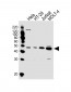 GLUL Antibody (N-term)