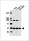 PCSK9 Antibody (N-term)