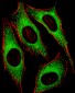 FGFR2 Antibody (N-term)