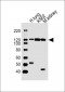 ROR1 Antibody