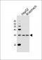 IPF Antibody (C-term)