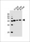 HAO1 Antibody (Center)