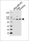 NCOA7 Antibody (N-term)