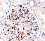 FABP4 Antibody