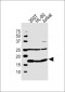 SUMO2 Antibody (C-term)