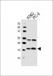 HIST1H2BM Antibody (Center)
