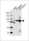 Mouse Rps6ka5 Antibody (C-term)