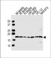 UBE2L3 Antibody (C-term)