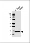 CCL15 Antibody